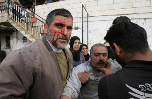 A Palestinian wounded in the head helps another injured man after tens of Israeli settlers attacked Palestinian houses with stones and fired live bullets in the divided West Bank city of Hebron on November 29, 2008. Five people were injured in the clashes between settlers and Palestinians outside a disputed house in Hebron, the Israeli army and witnesses said. The controversial house was occupied by dozens of hardline Jewish settlers in March 2007. They have remained in the building, which they dubbed 