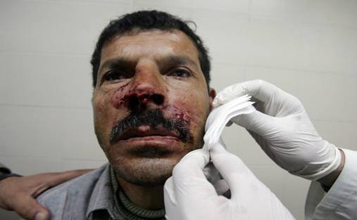 Palestinian Mohammed Zayed Abu Sneineh, 44, receives medical care at a hospital after a dog owned by Jewish settlers allegedly attacked him near the Ibrahimi Mosque or the Patriarch Tomb in the West Bank town of Hebron on December 1, 2008. With more than 170,000 Palestinian residents, Hebron is the largest city in the Israeli-occupied West Bank apart from annexed Arab east Jerusalem. It has long been a flashpoint because of a settler enclave of around 600 hardline Jews in the heart of the city, and a further 6,500 settlers living in Kiryat Arba on the outskirts. From Getty Images by AFP/Getty Images.
